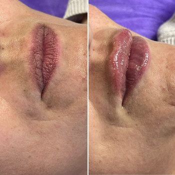 Наталія Книженко, Київ Фото - 22