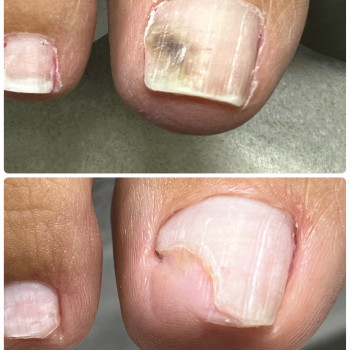 Подология
                    Мастер маникюра Наталья Кременчуг