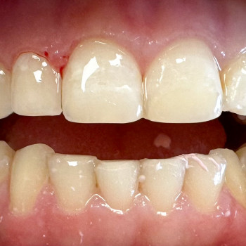 Фото з портфоліо фахівця Виолетта Максименко (стоматолог, Одеса)