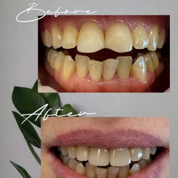 Фото з портфоліо фахівця Виолетта Максименко (стоматолог, Одеса)