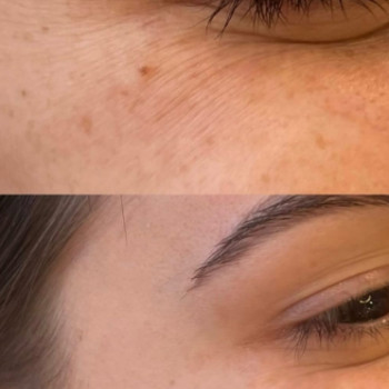 Фото з портфоліо косметолога Вікторія (Рівне)