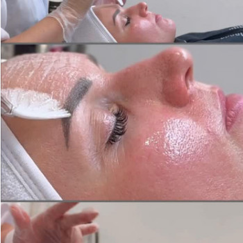 Оксана Гвоздецька, Рівне Фото - 5