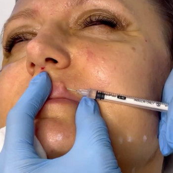 Наталья Побережнюк, Ровно Фото - 5