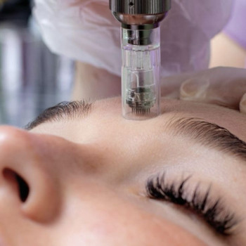 Фракційна мезотерапія
                    Лешмейкер Юлия Миколаїв