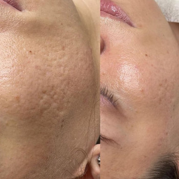 Юлия Журба, Николаев Фото - 7