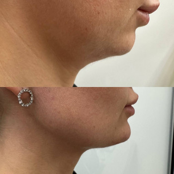 Марина Данилішина, Київ Фото - 7