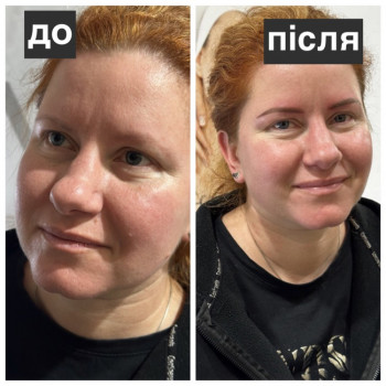 Helene, Киев Фото - 12