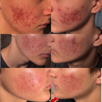 Юлия Юрина, Светловодск Фото - 2