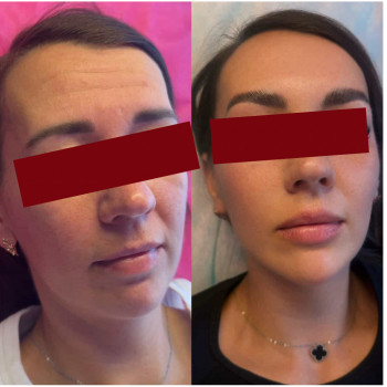 Юлия Юрина, Светловодск Фото - 3