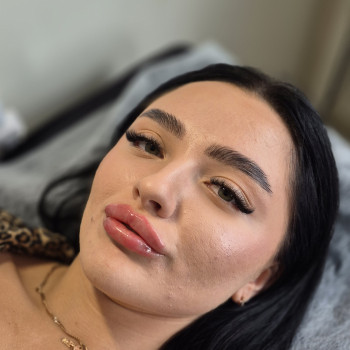 Контурна пластика губ
                    Косметолог-ін'єкціоніст Ольга Одеса