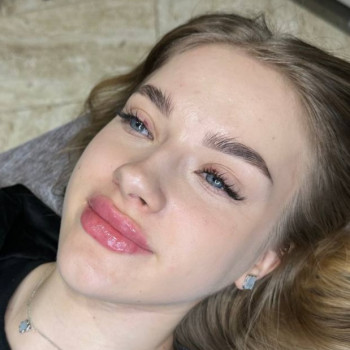 Контурна пластика губ
                    Косметолог-ін'єкціоніст Ольга Одеса