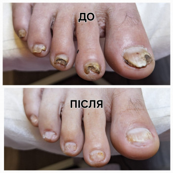 Альона , Днепр Фото - 7