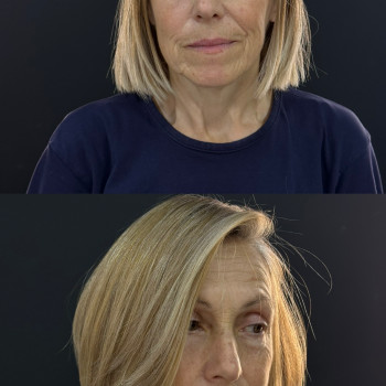 Жіночі стрижки
                    Парикмахер Анастасия Черновцы