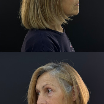 Жіночі стрижки
                    Парикмахер Анастасия Черновцы