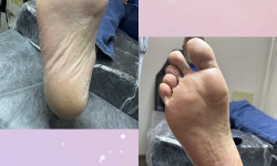 Медицинский мужской педикюр Подолог Анна Харків