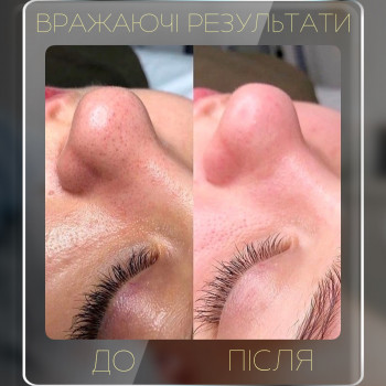 Salt Spa, Вараш Фото - 5