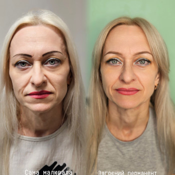 До та Загоєні брови