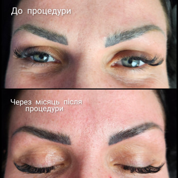 Удаление ремувером татуажа и тату
                    Мастер перманентного макияжа Наталя Харьков