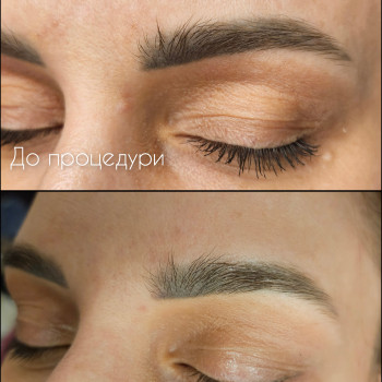 Удаление ремувером татуажа и тату
                    Мастер перманентного макияжа Наталя Харьков