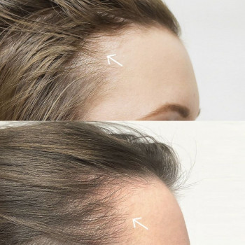 Трихопігментація
                    Майстер перманентного макіяжу Наталя Харків