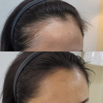 Трихопігментація
                    Майстер перманентного макіяжу Наталя Харків