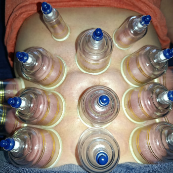 Антицеллюлитный массаж живота.
                    Массажист Иван Одесса