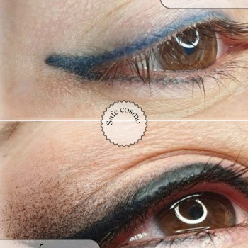 Стрілка з розтушуванням
                    Косметологический центр Safe Cosmo Kyiv Киев