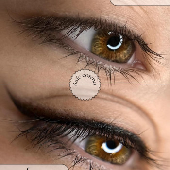 Стрілка з розтушуванням
                    Косметологический центр Safe Cosmo Kyiv Киев