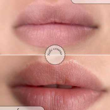 Акварельні губи
                    Косметологічний центр Safe Cosmo Kyiv Київ