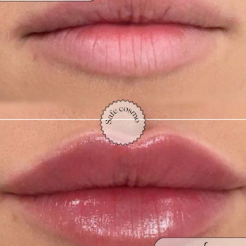 Акварельні губи
                    Косметологічний центр Safe Cosmo Kyiv Київ