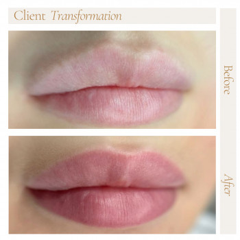 Акварельні губи
                    Косметологічний центр Safe Cosmo Kyiv Київ