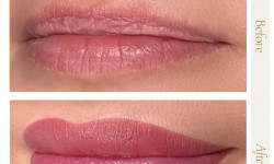 Помадні губи Косметологічний центр Safe Cosmo Kyiv Київ