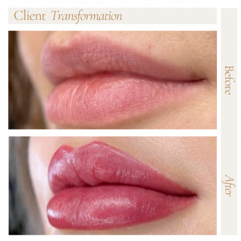 Помадні губи
                    Косметологічний центр Safe Cosmo Kyiv Київ