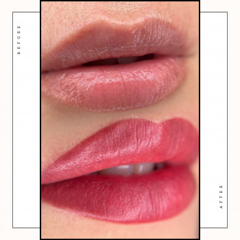 Помадні губи
                    Косметологічний центр Safe Cosmo Kyiv Київ