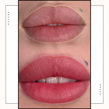 Помадні губи
                    Косметологічний центр Safe Cosmo Kyiv Київ