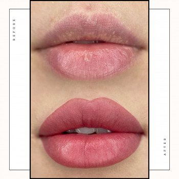 Губи 3D
                    Косметологічний центр Safe Cosmo Kyiv Київ