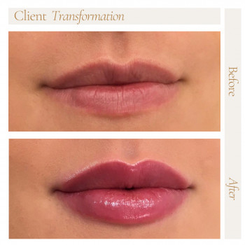 Корекція перманентного макіяжу
                    Косметологічний центр Safe Cosmo Kyiv Київ