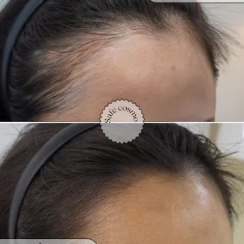 Трихопігментація
                    Косметологічний центр Safe Cosmo Kyiv Київ