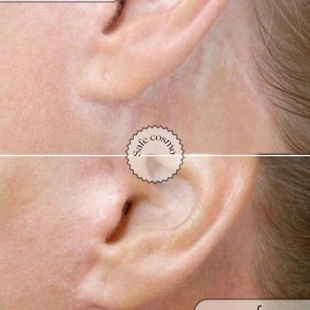 Медичний перманент
                    Косметологический центр Safe Cosmo Kyiv Киев