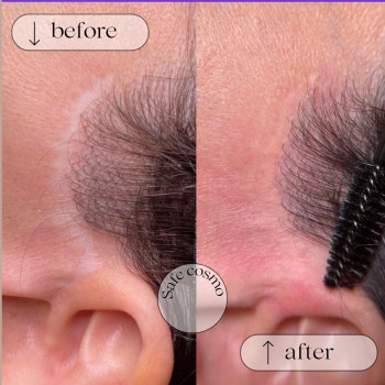 Медичний перманент
                    Косметологический центр Safe Cosmo Kyiv Киев