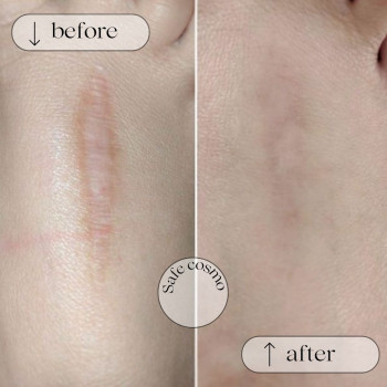 Медичний перманент
                    Косметологический центр Safe Cosmo Kyiv Киев