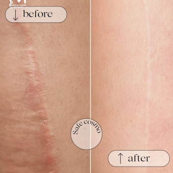 Медичний перманент
                    Косметологический центр Safe Cosmo Kyiv Киев