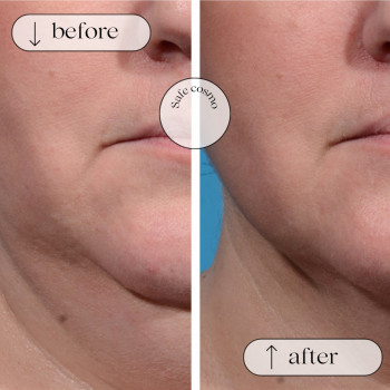 Ліполітики Непрямі
                    Косметологічний центр Safe Cosmo Kyiv Київ