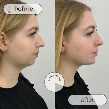 Ліполітики Непрямі
                    Косметологічний центр Safe Cosmo Kyiv Київ