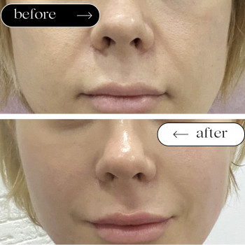 Ліполітики Непрямі
                    Косметологічний центр Safe Cosmo Kyiv Київ