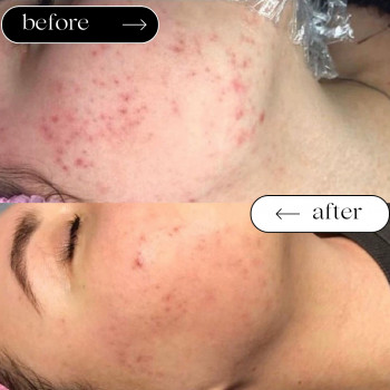 Ліполітики Непрямі
                    Косметологічний центр Safe Cosmo Kyiv Київ