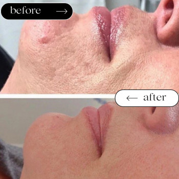 Ліполітики Непрямі
                    Косметологічний центр Safe Cosmo Kyiv Київ