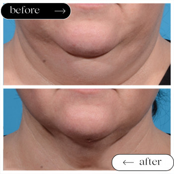 Ліполітики Непрямі
                    Косметологічний центр Safe Cosmo Kyiv Київ