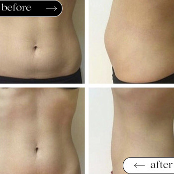 Ліполітики Прямі
                    Косметологічний центр Safe Cosmo Kyiv Київ