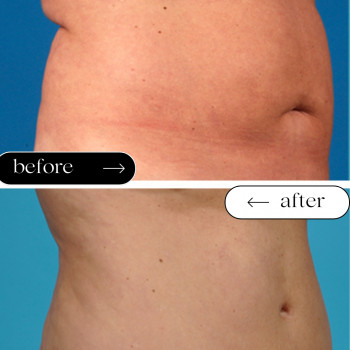 Ліполітики Прямі
                    Косметологічний центр Safe Cosmo Kyiv Київ